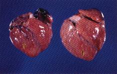 圖4：心室擴張內充滿凝血塊，血管怒張