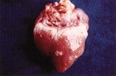 圖2：心肌呈現白色斑點病灶。