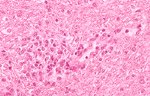 圖4：5 週齡 SPF 豬，人工感染 S94-4 豬瘟病毒第 6 天腦組織切片，於腦實質血管可見明顯的內皮細胞之細胞核，內皮細胞之數量有輕微增加等病變。
