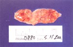 圖2：SPF 豬感染野外豬瘟病毒（S59）第 11 天，淋巴結鬆軟無力，周圍結締組織呈膠樣狀。