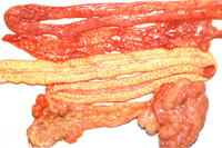 圖2:空腸部位嚴重出血,迴盲腸腸管肥厚易斷,粘膜表面覆蓋一層不易剝離的偽膜。