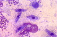 圖3：糞便抹片以Giemsa染色可見具有一個核，三條前鞭毛及波動膜的滴蟲蟲體。