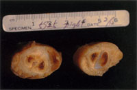 圖3：前肢橈、尺骨橫切面組織(已固定)，於骨幹部之皮質。