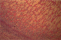 圖4：尺骨骨幹橫切面可見骨皮質增厚，骨小樑呈放射狀生長。H & E stain, 100X