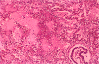 圖2：肺臟肺泡腔內可見水腫液、實質組織局灶性壞死。(H & E ; 100X)