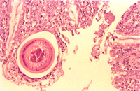 圖3：鞭蟲蟲體橫切面。
