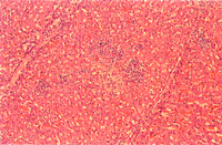 3. 脾：局部壞死，可見嗜酸性核內包涵體。 