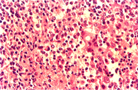 圖4：肝臟之高倍下可見嗜酸性核內包涵體。(箭頭所指)