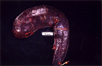 圖2：脾腫大為正常之2~3倍，長約30cm