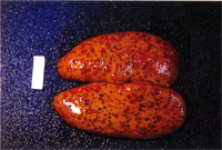 圖1：腎臟於皮質部可見密發大小不一圓型或斑狀外圍紅色中間淡紅之結節病變。