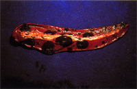 圖4：在高倍下可見腫瘤細胞藍染或淡染，細胞大小不一外型由卵圓型到多邊型，核質比高，質呈淡藍，偶爾可見有絲分裂相。