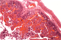 圖4：小腸粘膜層嚴重壞死及出血，粘膜下層及肌層可見氣腫及血管鬱血病變。