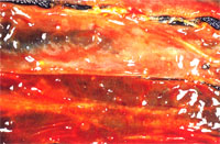 圖2：剖檢見腸管粘膜較薄，潮紅出血。