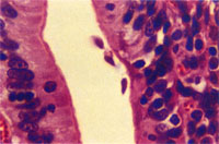 圖4：在空腸切片下可見到大量香蕉形狀的蟲體附著在腸管絨毛上皮細胞的頂端。