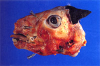 圖1：仔羊上下顎骨腫脹且變得較軟, 以注射針頭可以輕易地插入骨內。 