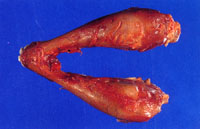 圖2：下顎骨腫脹之情形。