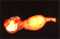 圖2：腺胃、肌胃罹病雞剖檢時可見腺胃明顯腫脹而肌胃萎縮，剖開時腺胃之粘膜層之乳突部常呈出血灶。