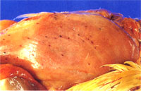 圖1：病雞胸肌多發0.1至0.2cm大小不一之紅色突出小點。