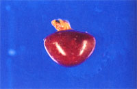 圖2：脾臟多發0.1～0.3cm大小不一之白色或紅色斑點。