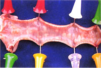 圖2：氣管黏膜可見多數圓形斑塊物附著。