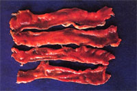 圖1：腸粘膜面瀰漫性出血, 並可見兩處帶狀出血。