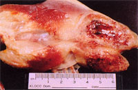 圖2： 胸部肌肉顯著腫大變硬， 可見黃白色乾酪樣壞死和出血於肌肉組織之間。
