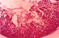 圖2：病理組織切片於低倍顯微鏡下，可見病鴨小腸黏膜面充血、絨毛上皮脫落、壞死。H & E, 100 X   