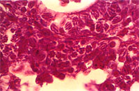 圖3： 病理組織切片於高倍顯微鏡下，腸上皮細胞內可見Oocyst、Schizonts等不同生長時期之球蟲蟲體。H & E, 1000 X