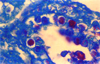 圖4： 以PAS染色法染病理組織切片並於高倍顯微鏡下觀察，可見腸上皮細胞內有Oocyst、Macrogametocytes、Microgame-tocytes等不同生長時期之球蟲蟲體。PAS, 1000 X