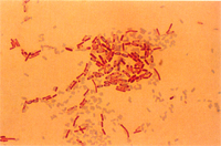 圖8： 小腸細菌分離株細菌抹片芽胞染色，可見細菌之芽胞(綠色)位於菌體(紅色)中央或次末端。1000 X