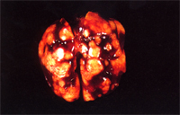 圖1：棒狀桿菌症，SD大鼠，肺臟呈紅白相間，斑駁狀，不規則狀大區域肝變實質化。