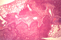 圖2：棒狀桿菌症，鏡檢下可見肺臟壞死區域呈廣泛擴張性，肺泡及小血管皆被破壞，嗜鹼性菌落浸潤，以壞死性肉芽腫病變為主。