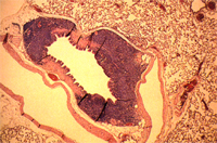 圖3：黴漿菌症，肺臟，圍小支氣管淋巴組織增生。