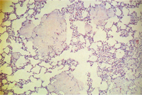 圖2：肺囊蟲症，肺臟可見肺泡腔多發散佈許多呈泡沫狀，嗜伊紅性顆粒樣並偶呈中空狀之物質，間質可見巨噬細胞浸潤。