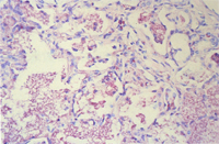 圖6： 高倍所見。