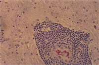 圖3： 狗肉芽腫性腦膜脊髓炎，(360 X)，炎症反應為清一色淋巴球。 H & E stain