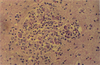 圖4： 狗肉芽腫性腦膜脊髓炎，(360 X)，炎症反應為混合性，組織球居多。 H & E stain
