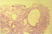 圖2：倉鼠的增生性迴腸炎組織病變。