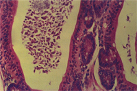 圖4： 倉鼠的輕度結腸炎。腸腺擴張，內含無數鼠螺旋核原蟲，本鼠為同研究計劃中之健康監測哨兵鼠(Health Screening sentinel animal) 有輕度結腸病變。