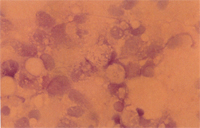 圖5： 脾臟、腎臟塗抹片染色鏡檢，可在吞噬細胞之細胞質中見到多量藍色顆粒，細胞核則被擠到一邊，疑似類立克次體。