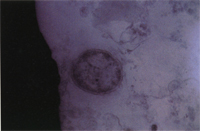 圖6： 在TEM下，細胞質中可見有似細胞壁般二層膜構造，外層膜呈波浪狀，符合立克次體的基本構造。