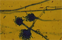 圖4： Lactophenol Cotton Blue 染色鏡檢，高倍相。可清楚看到菌絲。