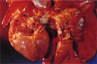 圖2： 肺動脈出口可見大量心絲蟲塞於血管腔內。