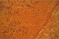 圖7：血管腔內可見許多微絲蟲。