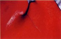 圖2：肝臟呈瀰漫性針點狀出血，肝小葉分隔明顯。