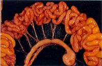 圖1：腸管淋巴結腫大，迴腸腸腔內充滿黃色液體。