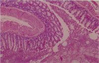 圖3：腸管絨毛壞死脫落，杯狀細胞增生，腸腔內可見大量的脫落壞死細胞及細菌團塊。 