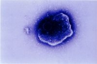 圖4：電子顯微鏡下之ILT病毒顆粒。 100,000X 