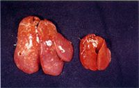 圖2：左邊肝臟腫大，並可見白色結節密發，右邊之肝為正常。