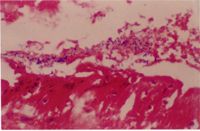 圖4：十二指腸壞死脫落的上皮細胞胞內於高倍下可見到長形的桿菌附著。   